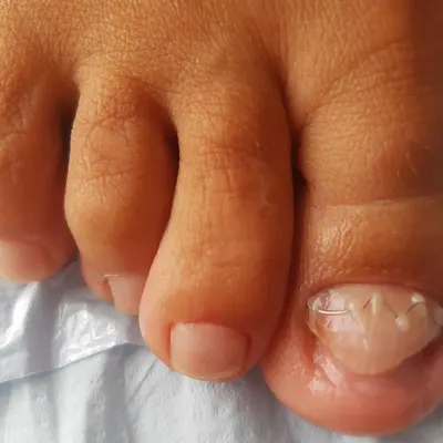 BoSo Gabinet Podologiczny Małgorzata Stompór